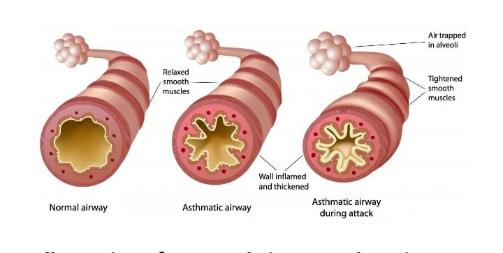 We shouldn't have to fight this hard to get our already incapacitated lungs protected from a virus that seriously affects the respiratory system @PHE_uk <a href="/CMO_England/">Professor Chris Whitty</a> <a href="/NHSEngland/">NHS England</a>NMD <a href="/uksciencechief/">Government Office for Science</a> <a href="/SMHopkins/">Susan Hopkins</a> @NHSEngland 
#AsthmaticsAtRisk #AsthmaticsUnder50