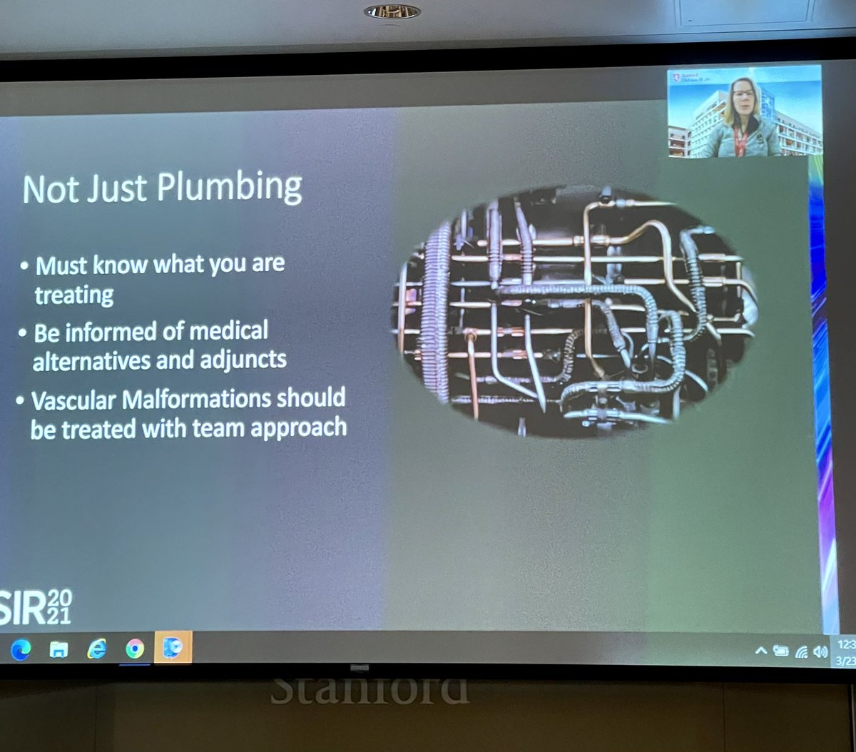 Victoria Young (@vyoungmd) on Twitter photo Exceptional presentation of medical therapy for vascular malformations at #SIR2021 today by Dr. Shellie Josephs of <a href="/Stanford_IR/">Stanford IR</a> <a href="/StanfordChild/">Stanford Children's</a> <a href="/StanfordMed/">Stanford Medicine</a>!!! #NotJustPlumbing #TeamApproach Exceptional presentation of medical therapy for vascular malformations at #SIR2021 today by Dr. Shellie Josephs of <a href="/Stanford_IR/">Stanford IR</a> <a href="/StanfordChild/">Stanford Children's</a> <a href="/StanfordMed/">Stanford Medicine</a>!!! #NotJustPlumbing #TeamApproach