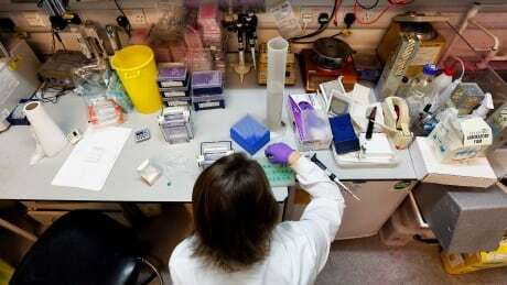 CBCNB's tweet photo. How researchers are tracking down N.B.'s mystery neurological disease: https://t.co/mJ4k8LqxxY https://t.co/8ZVKkugNqm