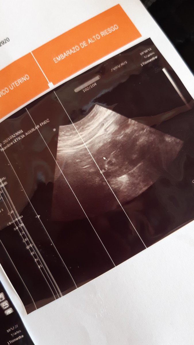 sighmochi's tweet photo. AMIS LES PRESENTO A MI FRIJOLITOOOOO, TIENE 5 SEMANAS 6 DÍAS Y PUEDE QUE NAZCA EN NOVIEMBRE 🥰💜 https://t.co/8M8dT3x4By