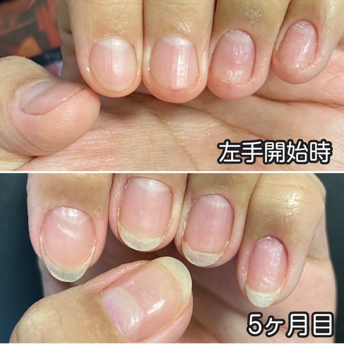 反り爪のtwitterイラスト検索結果 反り爪のtwitterイラスト検索結果