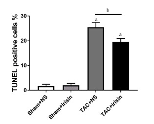 AmandaFregonas's tweet photo. #CardiacRemodeling 🫀occurs from changes in myocyte structure &amp; can lead to #HF. A new study examined the effects of a protein hormone called #Irisin in rats &amp; found that it ⬇️ the apoptotic rate (TUNEL pos %) of myocytes, among many outcomes #biom4180
https://t.co/L9p0OfRBar https://t.co/dwAzTp5fCr