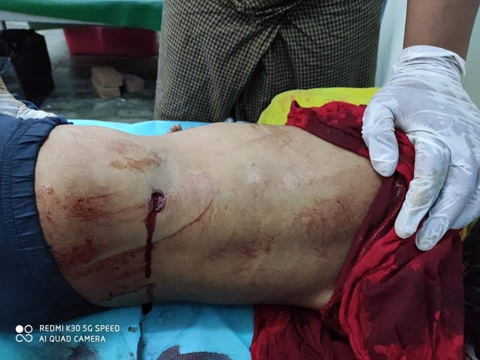 <a href="/YangheeLeeSKKU/">Yanghee Lee</a> 7 Year Old girl in Mandalay
#WhatHappeningInMyanmar 
#Mar23Coup