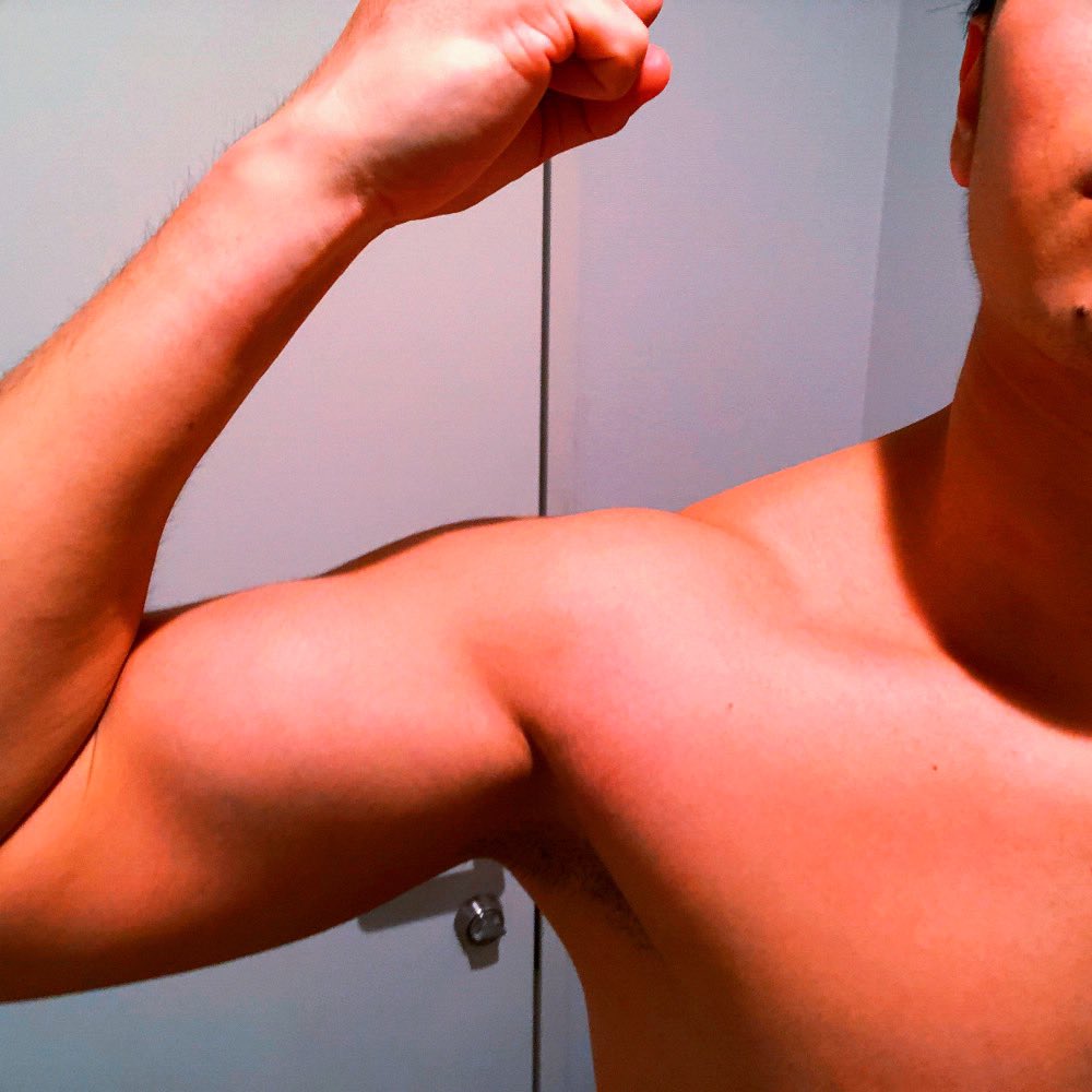 細胞核オーバーロード