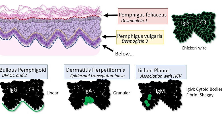 Recently got an example of my own <a href="/redsnapperpath/">Allison Osmond MD MSc FRCPC</a> #dermpath