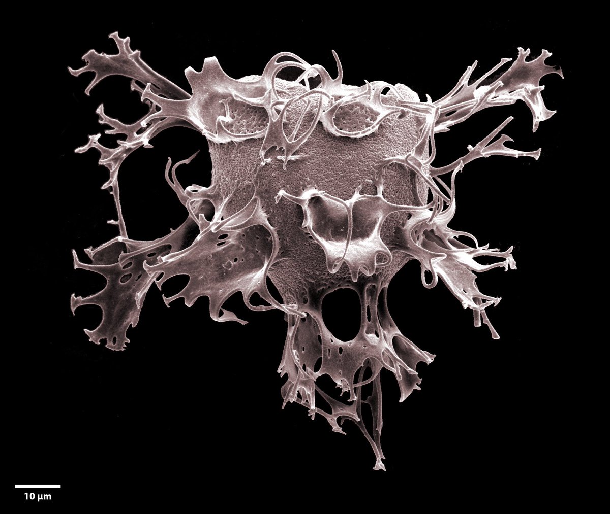 @JohnRMoffitt I see your beautiful Devonian trilobites and raise you a lovely fossil dinoflagellate hypnozygote, only 95 mill years old. Made of acid-resistant biopolymer, a few grams of rock can yield thousands of microplankton “dinocysts”. This is from a Cenomanian erratic in SW Norway.