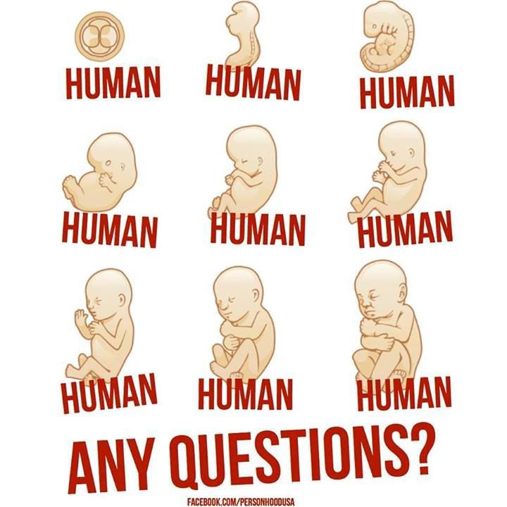 sangra91's tweet photo. #LifeWeek2021Life should be protected at all stages. https://t.co/vjjnZIQsm3