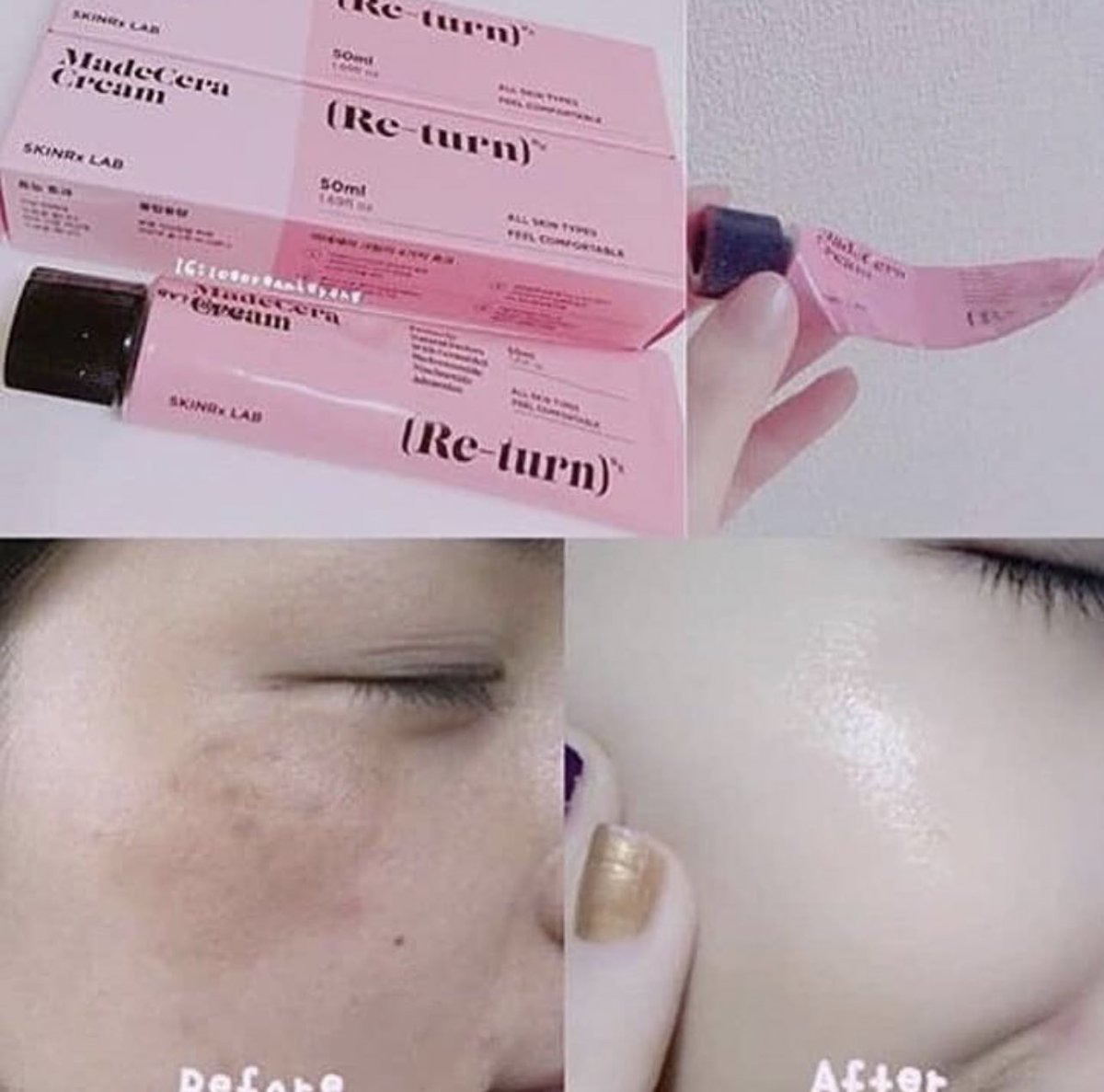 anyongstore's tweet photo. — #อันยองพร้อมส่ง
Skinrx lab madecara cream🌷
ตัวนี้จะเน้นลดรอยฝ้า กระ จุดด่างดำดูจางลง ผิวชุ่มชื้น ขาวเนียนขึ้น ไม่ทิ้งความมัน บำรุงผิวให้สว่างกระจ่างใส ดูอ่อนเยาว์ เป็นครีมที่แพทย์คลินิคศัลยกรรมแนะนำให้ใช้ เนื้อครีมสูตรเข้มข้น
ราคา : 490฿ 50ml
#skinrx #skinrxlab #คสอเกาหลี https://t.co/iNGYW9SpKs