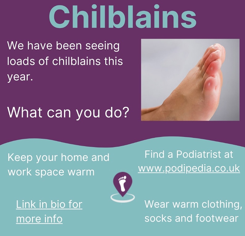 podipedia.co.uk/chilblains-and…