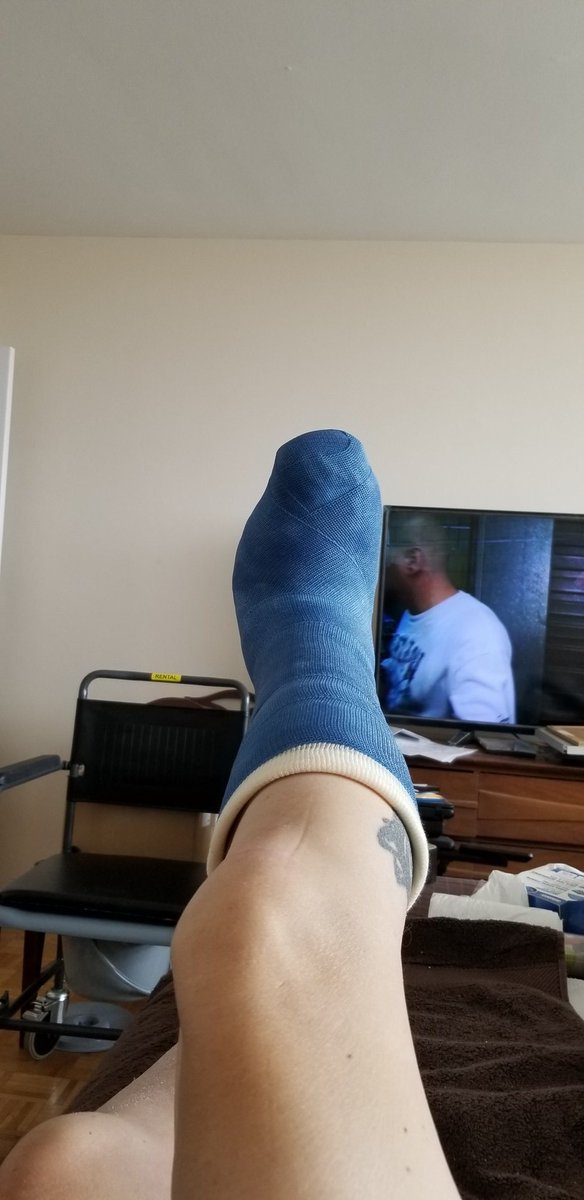 HalMyshrall's tweet photo. So it's been just over 21 days now since Doctor Joyce Fu  did the surgery to fix my foot and save it from amputation which there was never any need to. I now have almost full range of  motion which I have not had in years the pressure wound is almost heal the doctor is very happy https://t.co/dPzEGT68dE