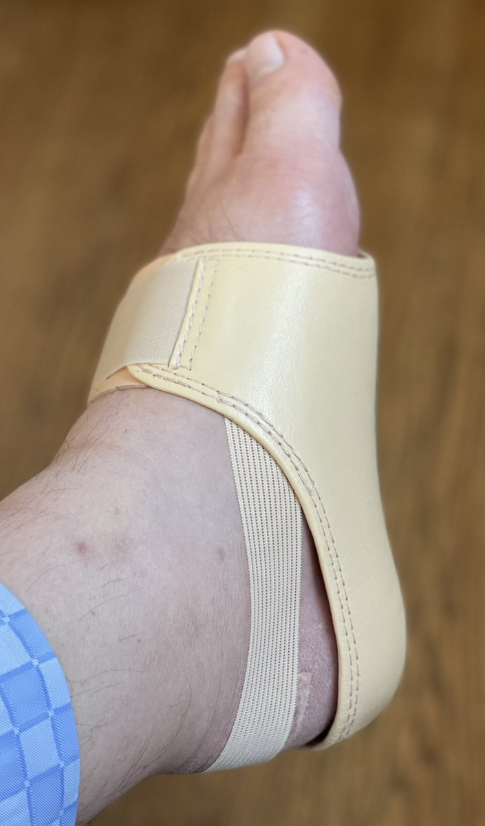 ルイ 女性によく間違われます 左足踵骨骨折入院生活25日目 足底板装着での歩行訓練が5日目 外側くるぶしと外側アキレス腱に痛みが走る 傷口も痛む リハビリの先生曰くリハビリです痛みは取れて行くとの事だが不安が残ります 片松葉杖歩行も