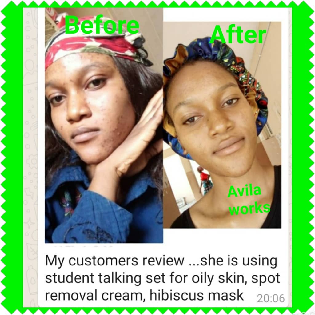 BDEssential's tweet photo. We are open for business!
Send in your order now!

Consultation is free!
You dont have to break the bank to look good 😊
Our products are of quality and affordable!

WhatsApp or call 08092571650 https://t.co/8RKuTjv944