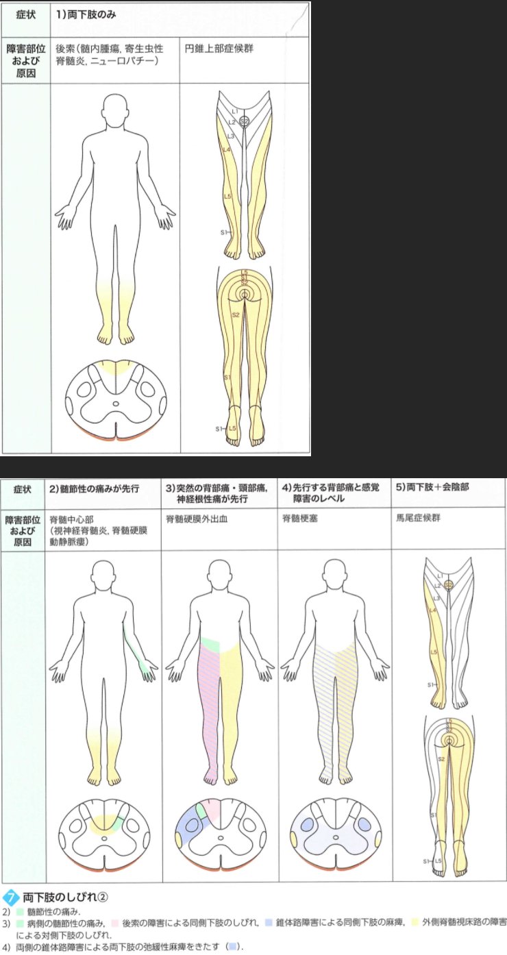 両側下肢のしびれ Check 髄節性の痛みが先行するか 突然発症であるか 感覚障害にレベルがあるか 会陰部を含むか T Co Yghgxyprtl Twitter
