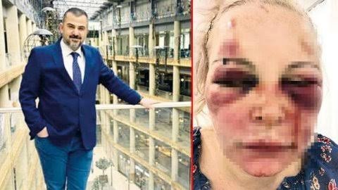 İstanbul'da Rus kadına otel odasında günlerce işkence edildi. Rus kadın, "İlk gün beni 5 saat boyunca tokatladı. Yüzümden akan kanlar eline bulaşınca yalıyor, 'Tadı ne güzel' diyordu." dedi. Otteva Elvira'ya günlerce işkence eden failin ismi ALP MUTLU.