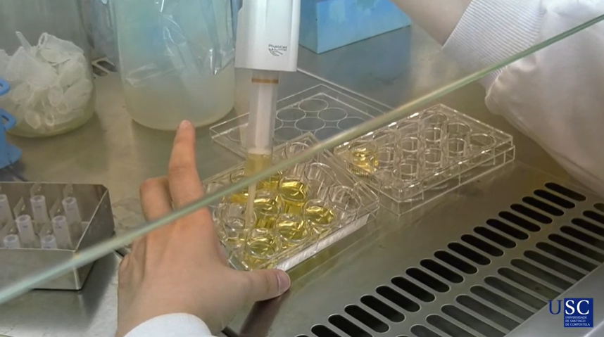 UniversidadeUSC's tweet photo. 🔬🦠“Fan falta moitas cousas para superar a #pandemia da #COVID19, e a #investigación é unha delas”.
🎦Nesta entrega de #SumoValor @feijoo_costa incide na importancia da facer partícipe a sociedade dos avances da @UniversidadeUSC 👇
https://t.co/FYBlcdEsZS
#estánatúaman https://t.co/d7RXXQdwqr