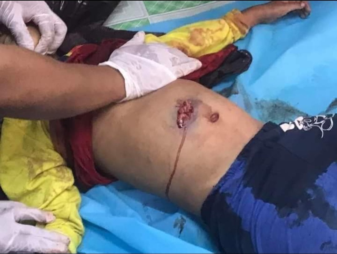 PhwayPh88637259's tweet photo. Tw // gunshot, Death
Innocent 7-year-old kid was shot in Mandalay while she was inside hee own house by Myanmar Military. 
Myanmar Military &amp; polices killed over 300 innocent peaceful protesters by now.. 💔
#WhatsHappeningInMyanmar
#ChildAbuse #RejectMyanmarMilitaryCoup https://t.co/erubJlPnsi