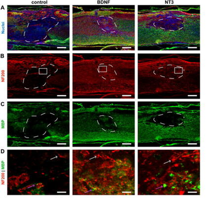 BiophysRev's tweet photo. Check out this research article in #AIP_APB demonstrating that, through the introduction of macropores in #hydrogel scaffolds, cells from #spinalcord tissues will infiltrate an implant more rapidly and improve #nerve #regeneration rates in injured areas.
https://t.co/HYQHOcJbf9 https://t.co/TYUBQ8ooDq