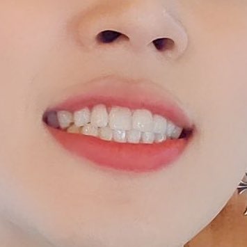 joonstudio's tweet photo. GASPS DID JIMIN WIPE THE CONCEALER OFF https://t.co/7wOsWLLwfS