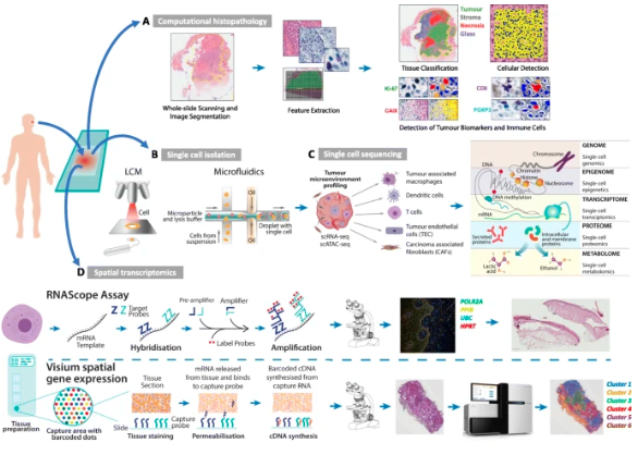 GenomeBiology's tweet photo. Editorial from @RoyRabbie, @David_J_Adams and co, discussing how genomics techniques can help us work out how tumors interact with their microenvironment, and in particular how single-cell techniques have revolutionized the field https://t.co/qP3V8Rjr1k https://t.co/YiE7yVfWkL