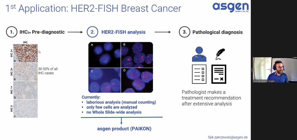 TheEMPAIA's tweet photo. Next presentation is by Falk Zakrzewski from #ASGEN about their product #PAIKON: “Automated HER2 gene amplification analysis on FISH Whole Slide Image” #BreastCancer #BreastCancerResearch #CancerResearch #DigitalPathology #ComputationalPathology https://t.co/sHBBeKDovm