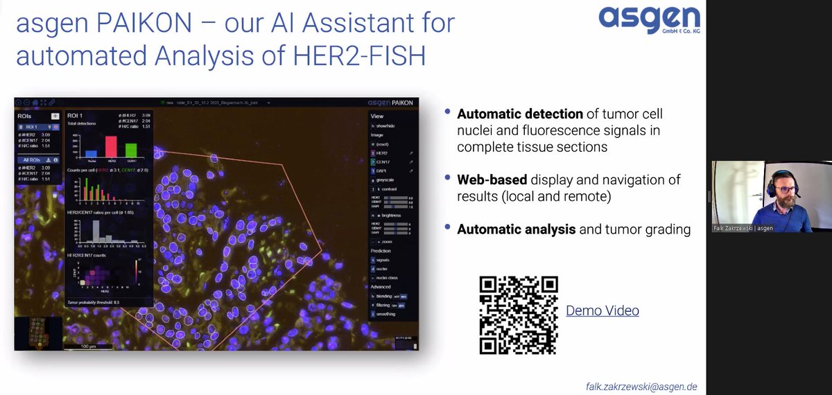 TheEMPAIA's tweet photo. Next presentation is by Falk Zakrzewski from #ASGEN about their product #PAIKON: “Automated HER2 gene amplification analysis on FISH Whole Slide Image” #BreastCancer #BreastCancerResearch #CancerResearch #DigitalPathology #ComputationalPathology https://t.co/sHBBeKDovm