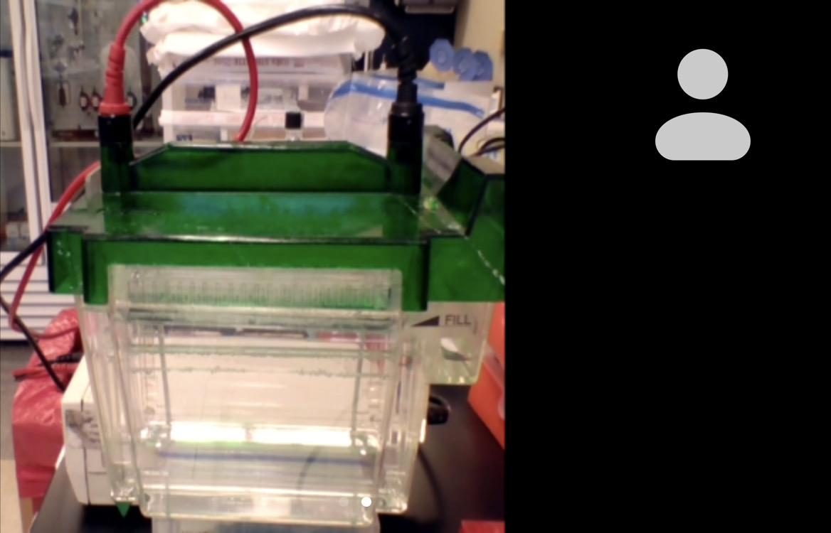 ArabTanina's tweet photo. zoom call your gel is not just fun! it does also save time by avoiding going back and forth when doing multiple experiments simultaneously in different rooms in the lab   #HappyResearcher #ExperimentHacks @SNEVresearch @AcademicChatter https://t.co/1HO6AisW0Y