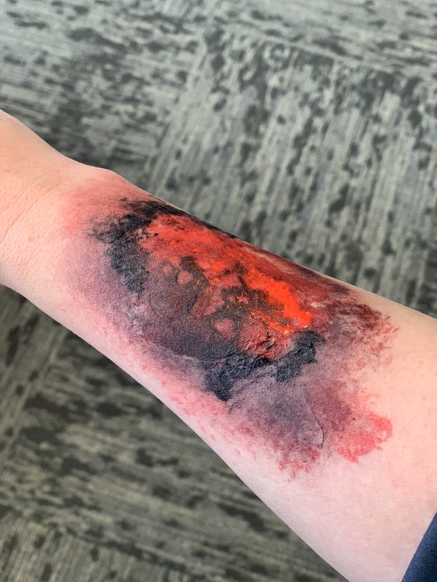 LeeUSimCentral's tweet photo. Practicing some #moulage #burns https://t.co/hSbfOfkElA