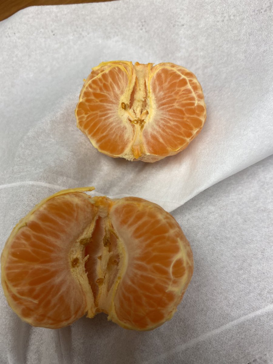 ae0501's tweet photo. @cutiescitrus what is this??? https://t.co/lCn0lclgkU