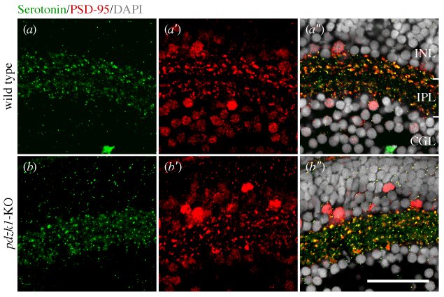 UniMelbDOVS's tweet photo. Congratulations bioscience psychology ⁦@UniMelbDOVS⁩ team⁩ ⁦@JiahengXie⁩ ⁦@pr_jusuf⁩ Stephanie Dudczig ⁦@TamarSztal⁩ ⁦@ptgoodbourn⁩ showing autism schizophrenia linked gene modifies visual function (https://t.co/ynZ31jlQUL) ⁦@UniMelbMDHS⁩ https://t.co/mPQ9c02s3P