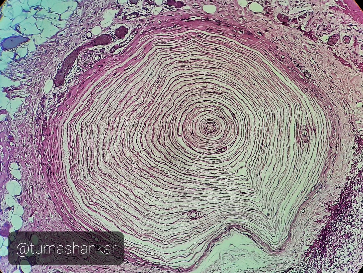 tumashankar's tweet photo. Chakravyuh.. but easy to exit..😂
.
.
@archibhat3 @VijayPatho @lovelygeorge10 @Swathiprabhu5 @Vasudevprabhu3 #PathTwitter #Tweacher #PathTweacher https://t.co/mIvnnPNHXu