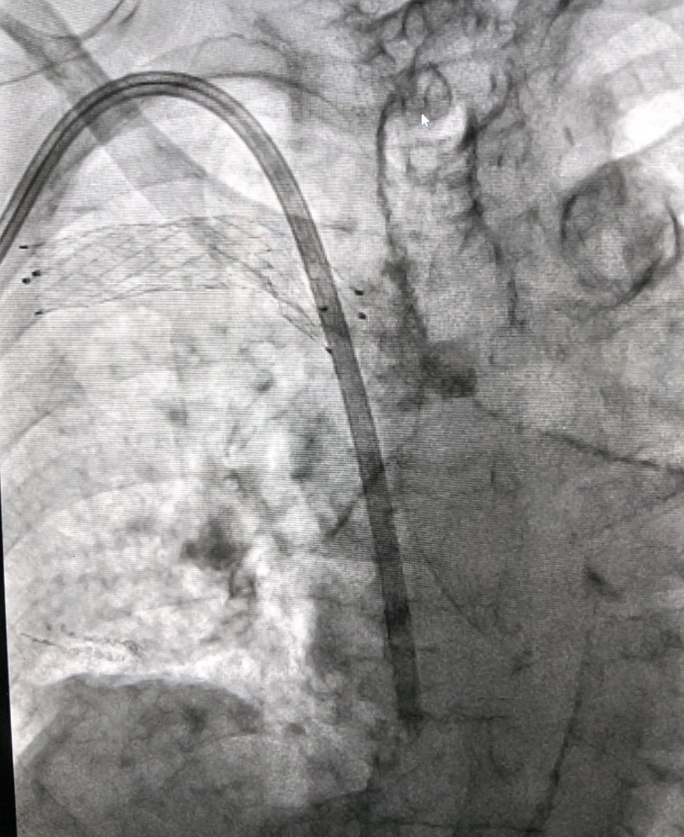 LessneVIR's tweet photo. Public service announcement:
Keep ruining the already ruined side before you start ruining the unruined side #SaveTheAccess
#IRad @SIRspecialists https://t.co/N16MS2CD6N