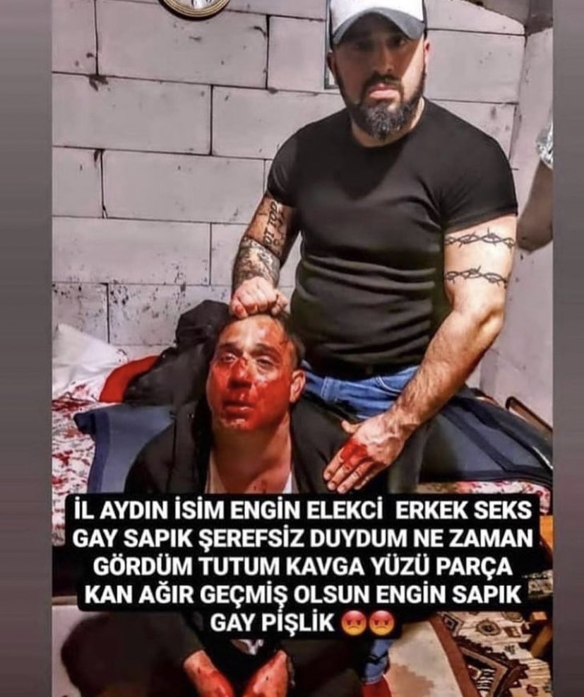 aydın’da, fırat delikanlı isimli homof*bik bir şahıs, escinsel olduğu gerekcesiyle isitme engelli engin elekçi isimli bir masumu agir bir şekilde darp ediyor ve yetmezmiş gibi darp ettikten sonra fotograflayip internette paylaşıyor. 
#FıratDelikanlıTutuklansın <a href="/pqueenn/">osman</a>