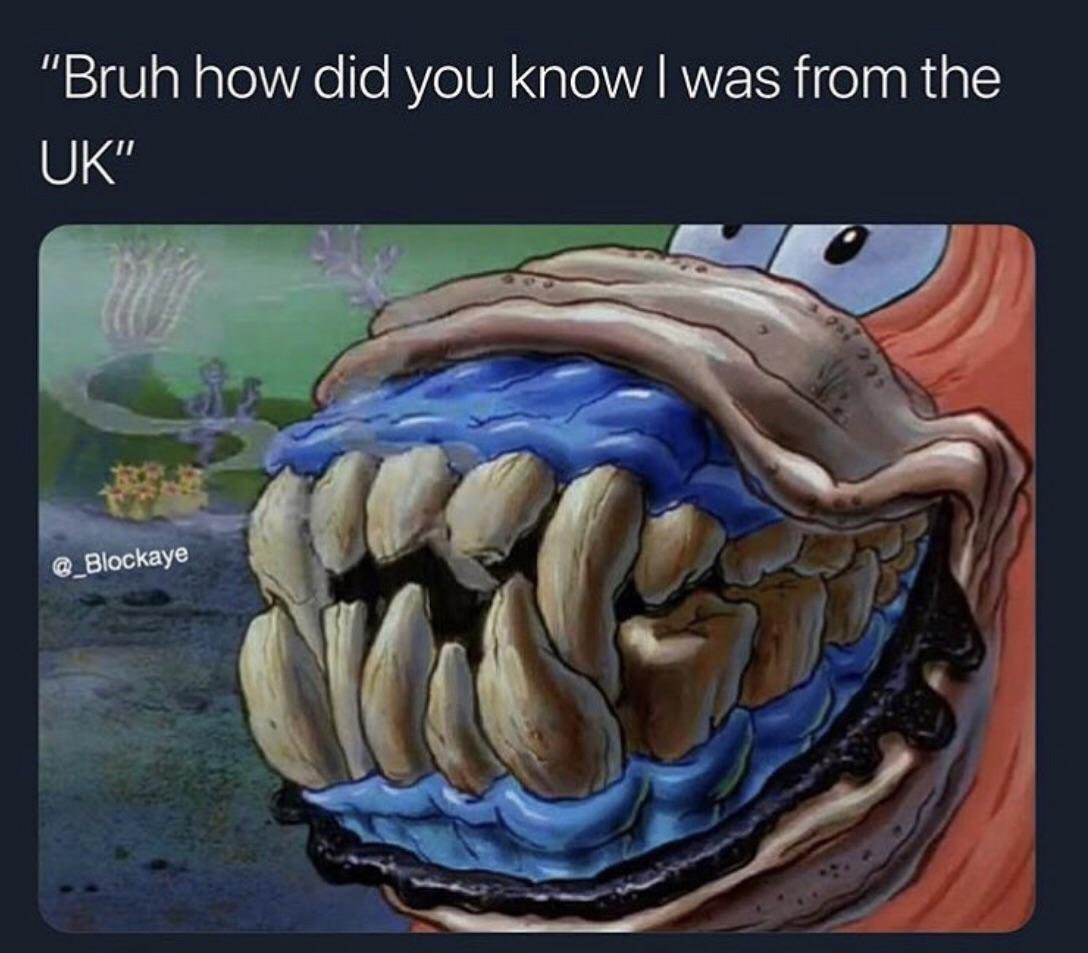 UnNoxyy's tweet photo. @Sora_reina_ @420smokedawg @justinswillow @Valkyrae “Mate” LOLLL 😭. people with yellow teeth talking out here man https://t.co/qoy3ZIIMw6