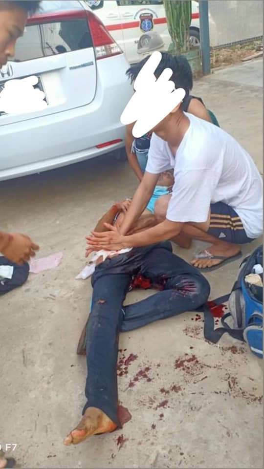 LizzieP83275168's tweet photo. Tw // blood 

One civilian got shot in the abdomen and is now in critical condition as terrorists violently crack down the protest with tear gas and live ammunitions at Hlaing-Bwe, Hpa-an Township  around 7 am today.
STOP ABDUCTIONS
#WhatsHappeningInMyanmar
#Mar25Coup https://t.co/xoj4P9Gwco