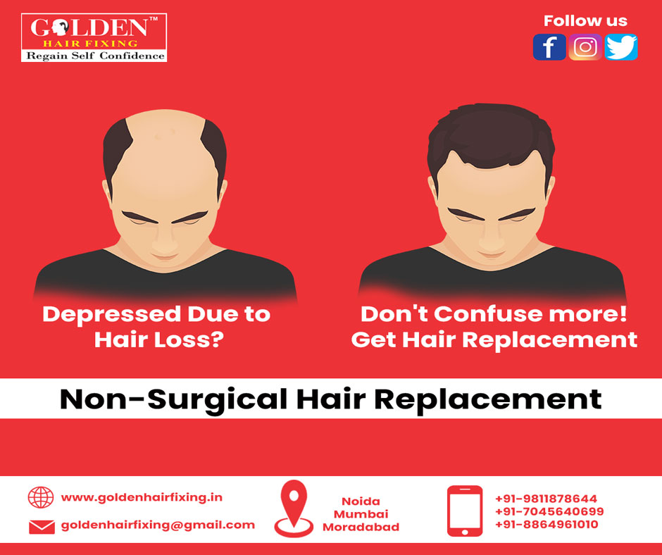 Golden Hair Fixing (@GoldenFixing) / Twitter Golden Hair Fixing (@GoldenFixing) / Twitter