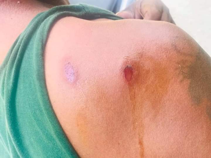 KathIris20's tweet photo. Happening now in Mawlamyine; A man who s trying to protect a gunshot victim was shot with rubber bullets! That victim who was shot with live ammo escaped from cops, Witness says! 

STOP ABDUCTIONS

#WhatsHappeningInMyanmar
#Mar25Coup
#InternetShutdown https://t.co/JWxmevJDPV