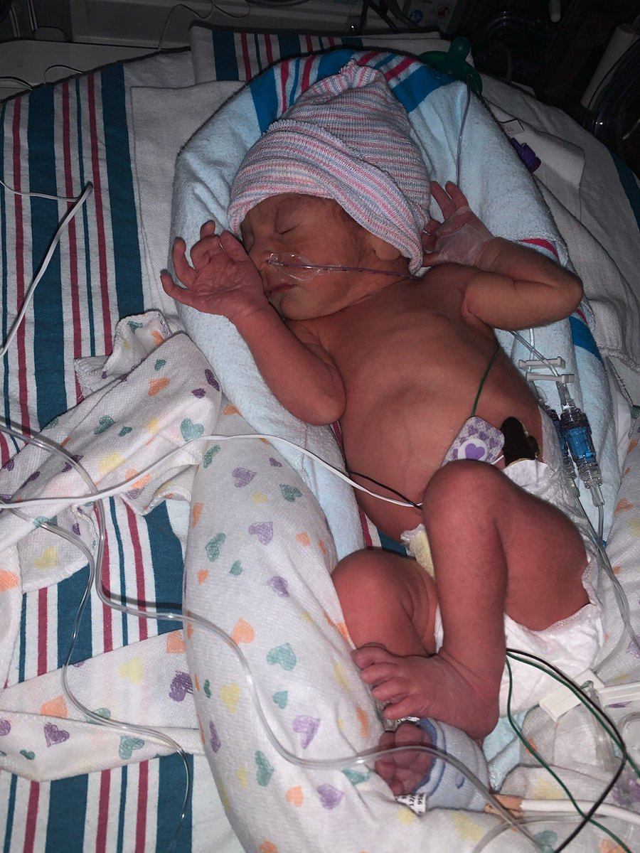 deisyr_10's tweet photo. Pregnant, premature, now 🥺💙💙 https://t.co/547euJcPwR