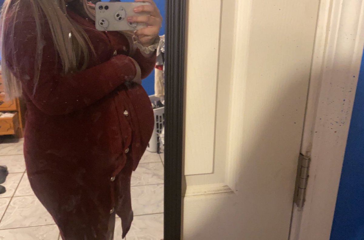deisyr_10's tweet photo. Pregnant, premature, now 🥺💙💙 https://t.co/547euJcPwR