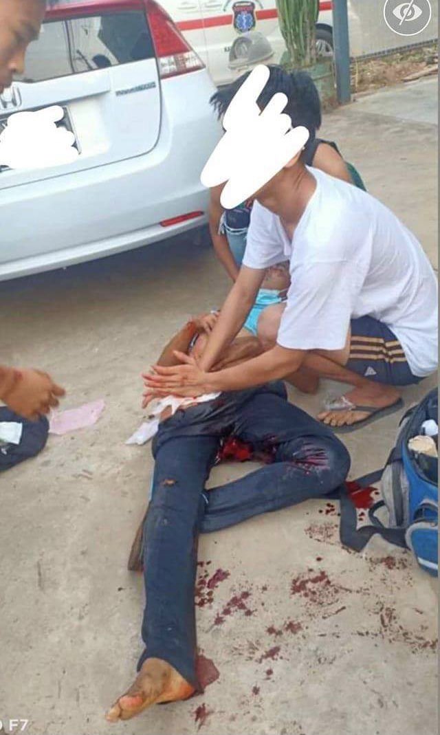 TW // Blood
Terrorists violently crackdown peaceful dawn strike in #HpaAn using tear gas and rubber bullets. One protester was injured. #WhatsHappeningInMyanmar #Mar25Coup