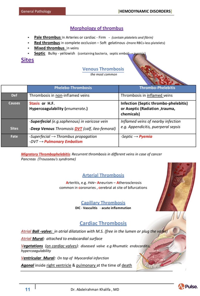 biochem48's tweet photo. ✅ ملخص جميل عن Thrombosis 🩸 https://t.co/EyVifNwdJq