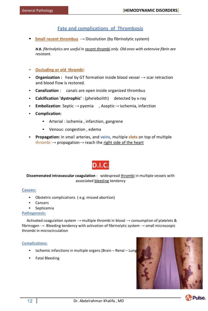biochem48's tweet photo. ✅ ملخص جميل عن Thrombosis 🩸 https://t.co/EyVifNwdJq
