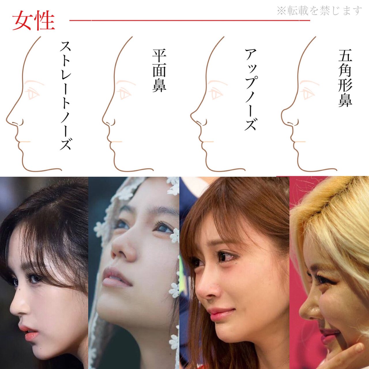 鼻整形の名医相談 小鼻縮小 鼻翼縮小 鼻尖形成 鼻中隔延長 鼻尖縮小 二重整形 プロテーゼの失敗 鼻の横顔シルエット図 女性版と男性版に分けました ストレートノーズ 自然に鼻筋が通っている 平面鼻 ナチュラルな童顔 アップ
