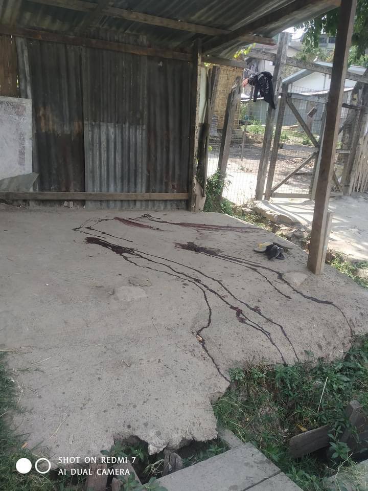 hannayuri_twt's tweet photo. tw // blood
Another young civilian was shot DEAD in the chest with live ammunitions by Military Junta Group at KanThar Strike, #Taunggyi around 2PM. 
Total 2 dead were recently reported today. 
#WhatsHappeningInMyanmar
#Mar25Coup https://t.co/NoA7FPP8D4