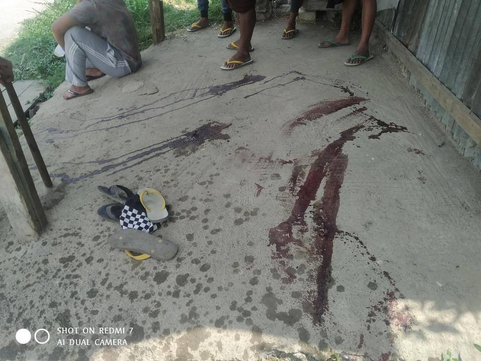hannayuri_twt's tweet photo. tw // blood
Another young civilian was shot DEAD in the chest with live ammunitions by Military Junta Group at KanThar Strike, #Taunggyi around 2PM. 
Total 2 dead were recently reported today. 
#WhatsHappeningInMyanmar
#Mar25Coup https://t.co/NoA7FPP8D4
