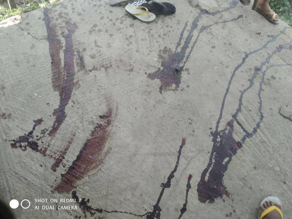 hannayuri_twt's tweet photo. tw // blood
Another young civilian was shot DEAD in the chest with live ammunitions by Military Junta Group at KanThar Strike, #Taunggyi around 2PM. 
Total 2 dead were recently reported today. 
#WhatsHappeningInMyanmar
#Mar25Coup https://t.co/NoA7FPP8D4