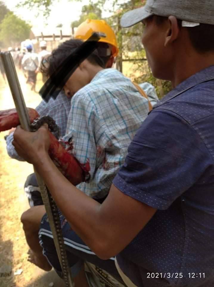 BoRam10220's tweet photo. Happened at Khin Oo city, Sagaing Region. Junta(SAC) shot continuously( around 100 open fires), 3 civilians have seriously injured and they are also raiding houses.
STOP ABDUCTIONS
#Mar25Coup
#WhatsHappeningInMyanmar
#InternetShutdown https://t.co/70CpjMVkvy