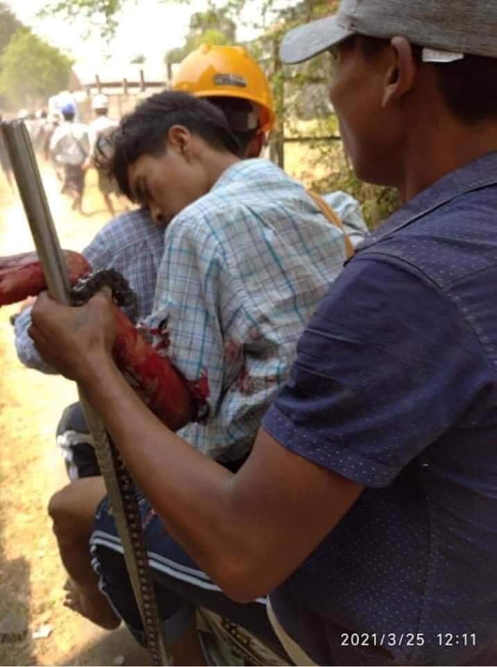 Zinlayy3's tweet photo. Tw // graphic content⚠️
Terrorist group(SAC) are shooting with both live ammunition &amp; rubber bullets to innocent civillians in Khin-U, SHWE BO, Sagaing. At least 3 people was shot reportedly and one in critical condition.

STOP ABDUCTIONS #WhatsHappeningInMyanmar 
#Mar25Coup https://t.co/RZO7mYwdLN
