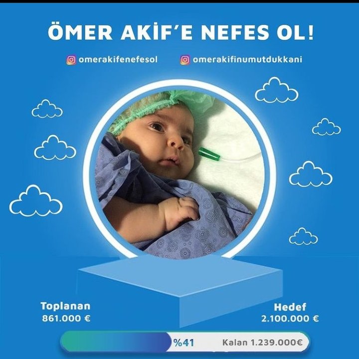 Desteklerinizle %41 olduk.Yolun yarısına çok az kaldı.Ömer Akif’in size şimdi daha çok ihtiyacı var.Lütfen oğluma alamadığı nefesi hediye eder misiniz? 

VAKIFBANK

Iban;
TR47 0001 5001 5800 7312 3453 57
ALICI: ÖMER AKİF KAYA AÇIKLAMA KISMINA; 'ÖMER AKIF'E NEFES OL' YAZINIZ

#sma