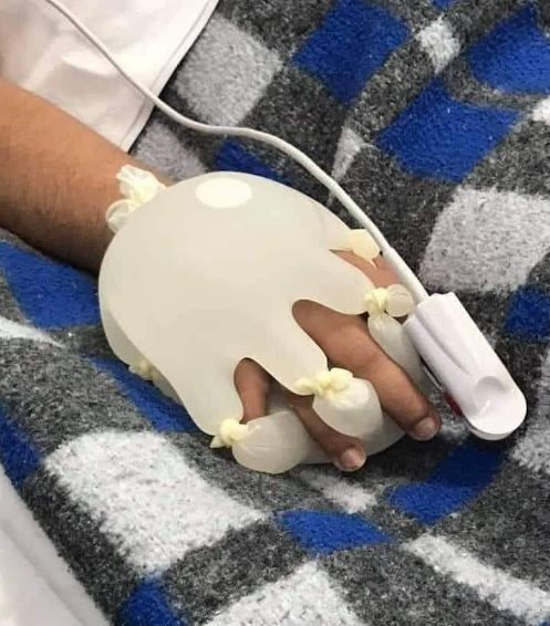 CeliaNacarato's tweet photo. Enfermeira Lidiane Melo fez a luva com água quente para melhorar a perfusão do paciente e dar a sensação de q alguém segurava sua mão. Nossas orações por todas enfermeiras(os) e pessoal da linha de frente em hospitais, UBSs e clinicas médicas! Obrigada!🙏🙏🏽😢 https://t.co/I2TOnatwdJ