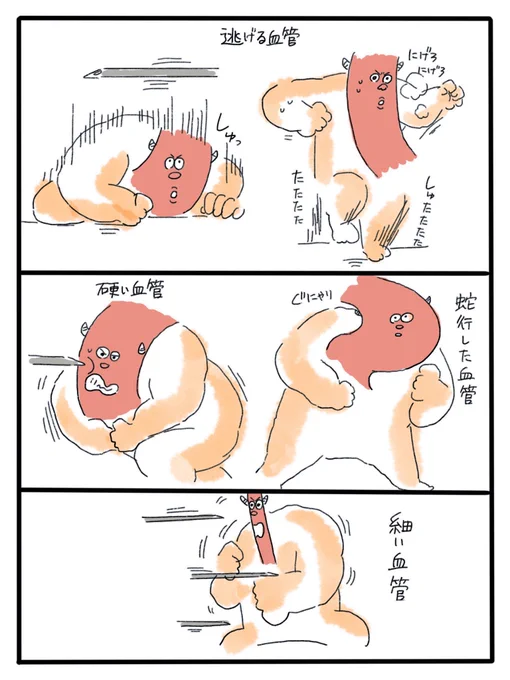 いろんな血管。 
